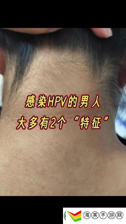 一个男人有两个女人同时感染HPV