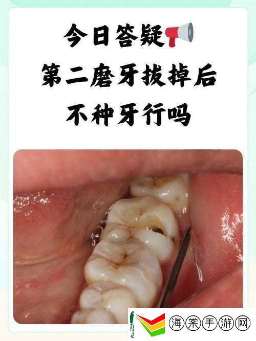 揭秘二次灭绝游戏中原始尖牙的获取之道